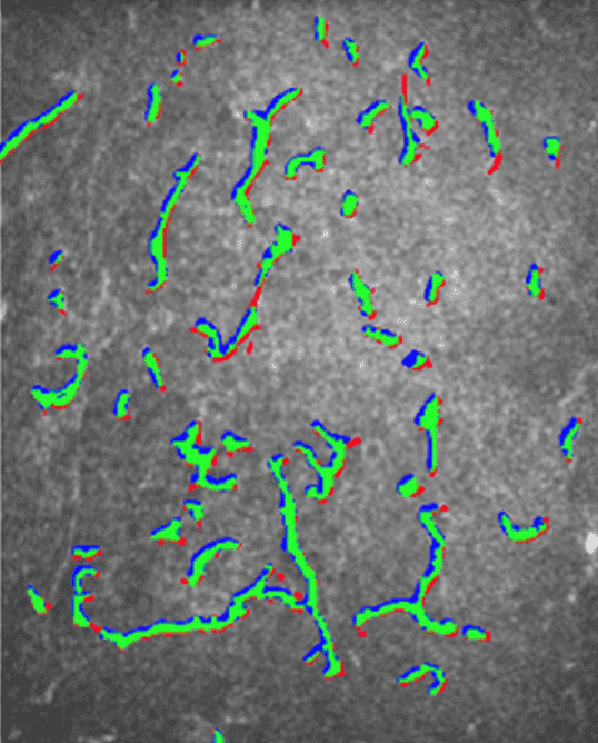 deep learning cell segmentation