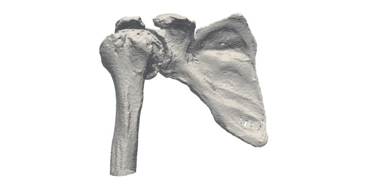 Shoulder Segmentation