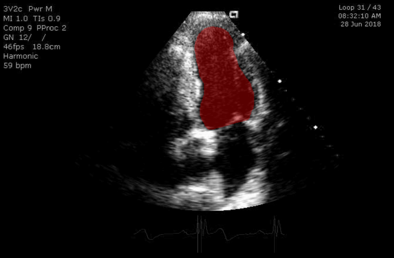 ultrasound