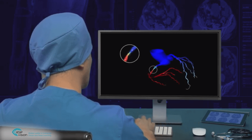 Coronary-Intervention